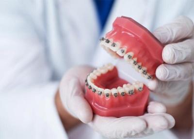 چه کسانی احتیاج به ارتودنسی دندان دارند؟